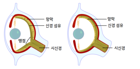 사람의 눈이 문어의 눈과 다른 점